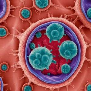 Prévention des infections urinaires en EHPAD